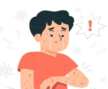 Monkeypox Merajalela, Segera Cegah dengan Lakukan Ini!