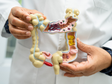 Kesehatan Usus dan Hubungannya dengan Kulit Sehat